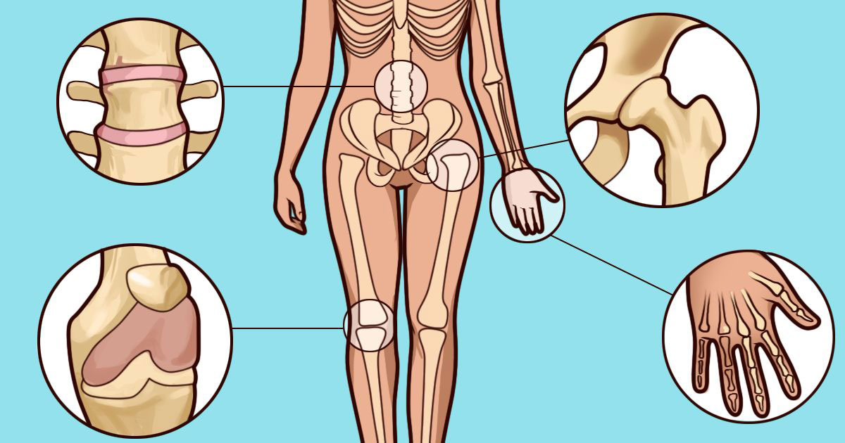 http://www.conocersalud.com/wp-content/uploads/2017/02/sintomas-artritis.jpg