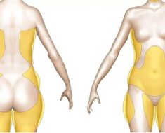 Medicina oriental, adelgazar 5 kilos en dos semanas es posible eso, deje que Adelgazar 5 kilos en dos semanas es posible verde para
