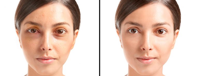 6 maneras fáciles de reducir el estrés naturalmente