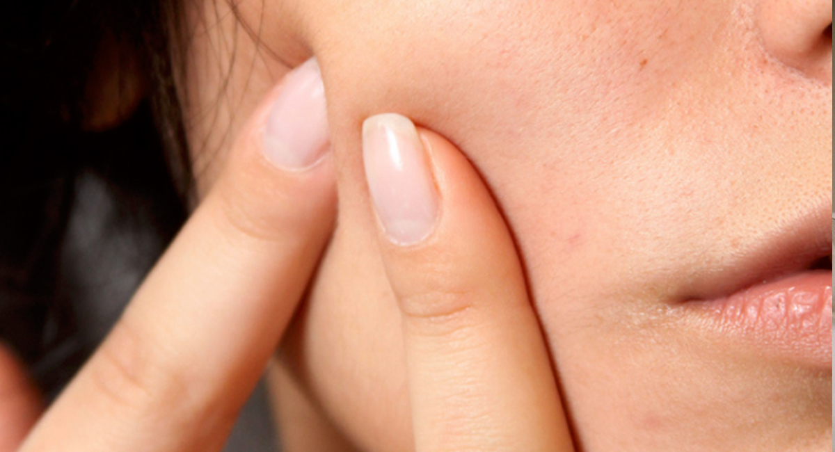 Deje de comer estos 5 alimentos si desea deshacerse del acné Conocer