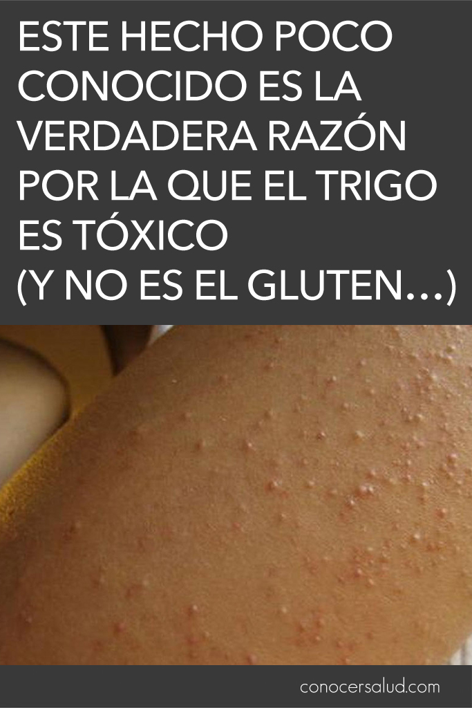 Este hecho poco conocido es la verdadera razón por la que el trigo es tóxico (Y no es el gluten...)