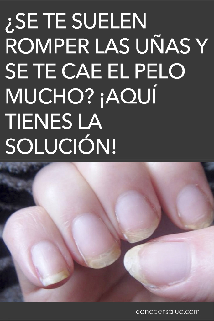 ¿Se te suelen romper las uñas y se te cae el pelo mucho? ¡Aquí tienes la solución!