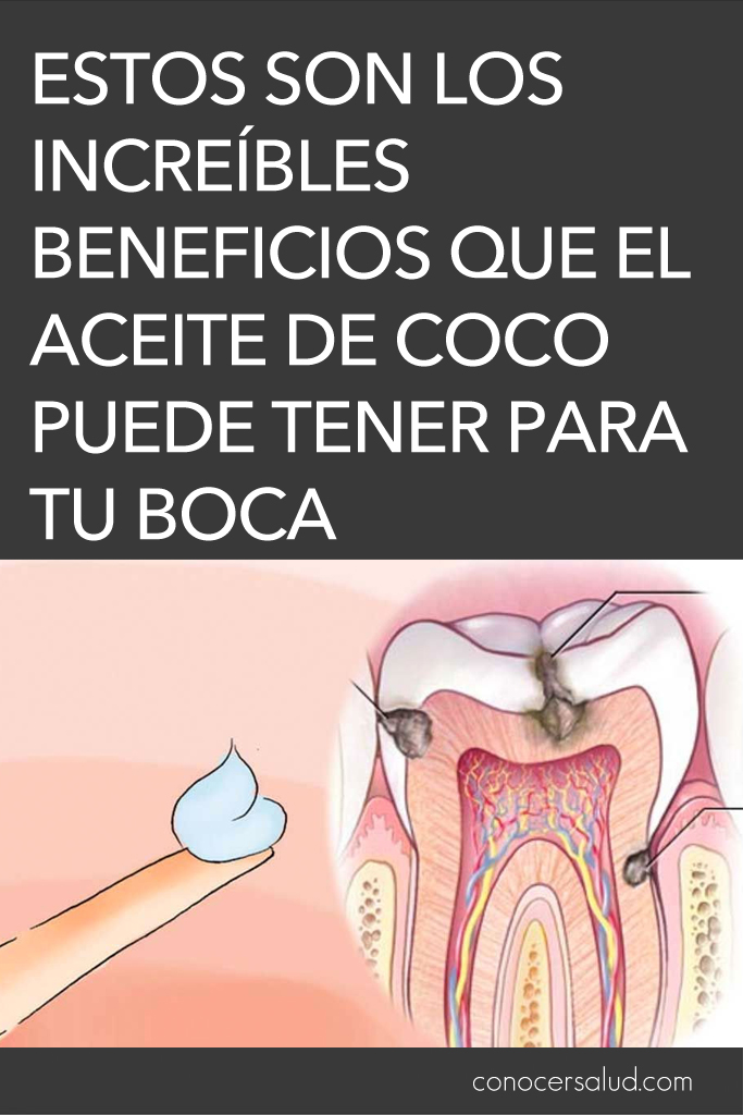 Estos son los increíbles beneficios que el aceite de coco puede tener para tu boca