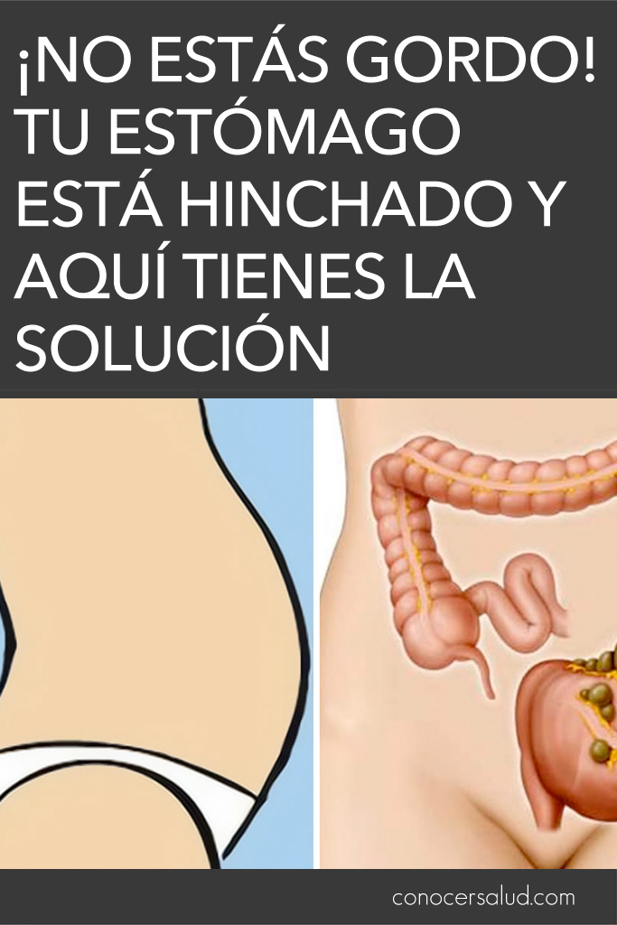 ¡No estás gordo! Tu estómago está hinchado y aquí tienes la solución