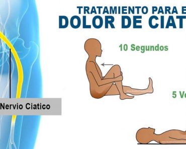 6 de los mejores ejercicios para tratar la ciática y el dolor de espalda