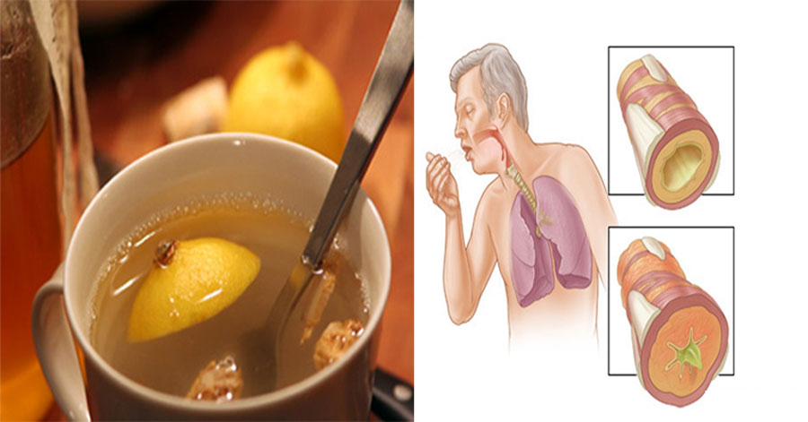 Este elixir de 3 ingredientes limpia el moco de los pulmones y fortalece el sistema inmunológico