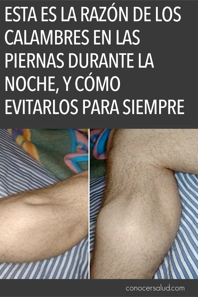 Esta es la razón de los calambres en las piernas durante la noche, y cómo evitarlos para siempre