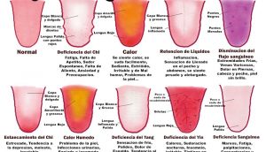 ¿Qué dice tu lengua sobre tu salud? Comprueba tu estado por su color