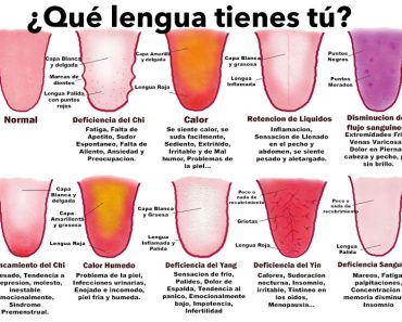 ¿Qué dice tu lengua sobre tu salud? Comprueba tu estado por su color