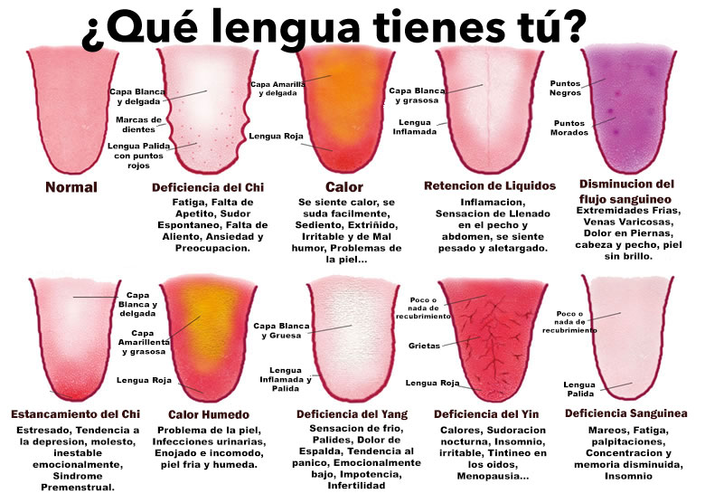 ¿Qué dice tu lengua sobre tu salud? Comprueba tu estado por su color