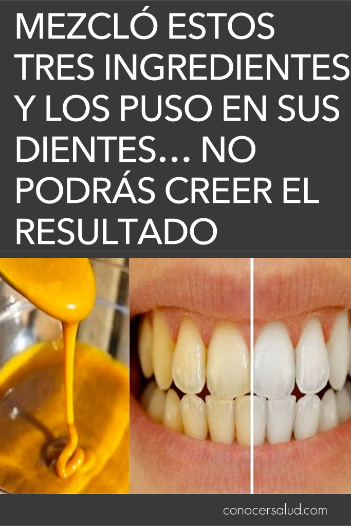 Mezcló estos tres ingredientes y los puso en sus dientes... No podrás creer el resultado