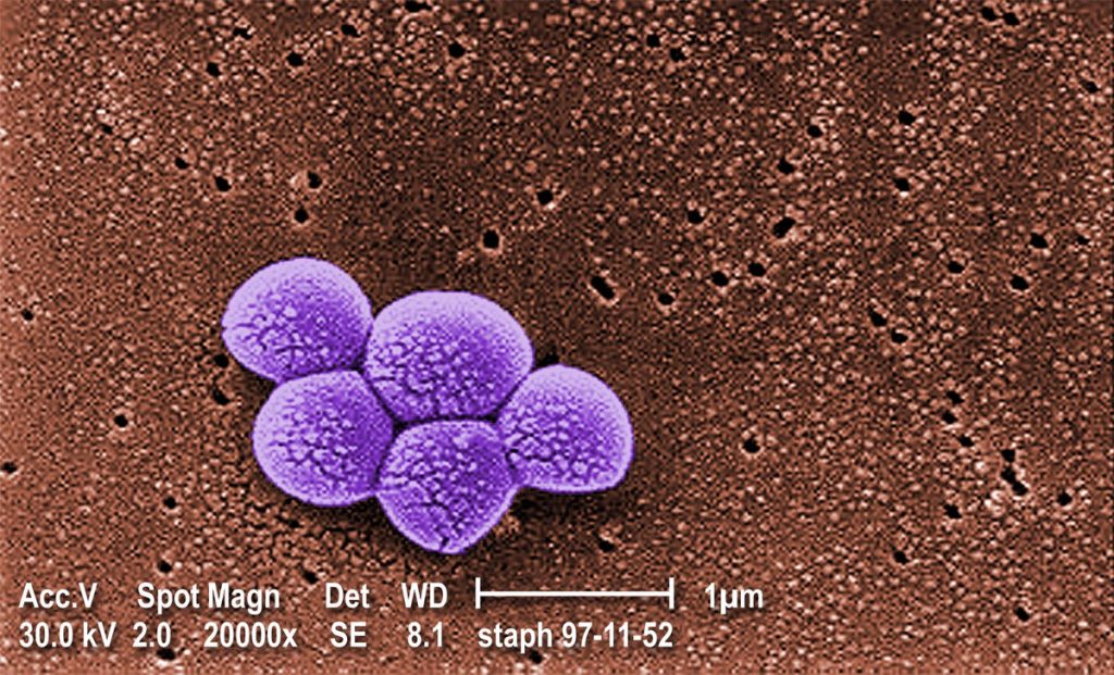 SARM: todo Lo que necesitas saber sobre esta "superbacteria"