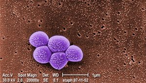 SARM: todo Lo que necesitas saber sobre esta "superbacteria"