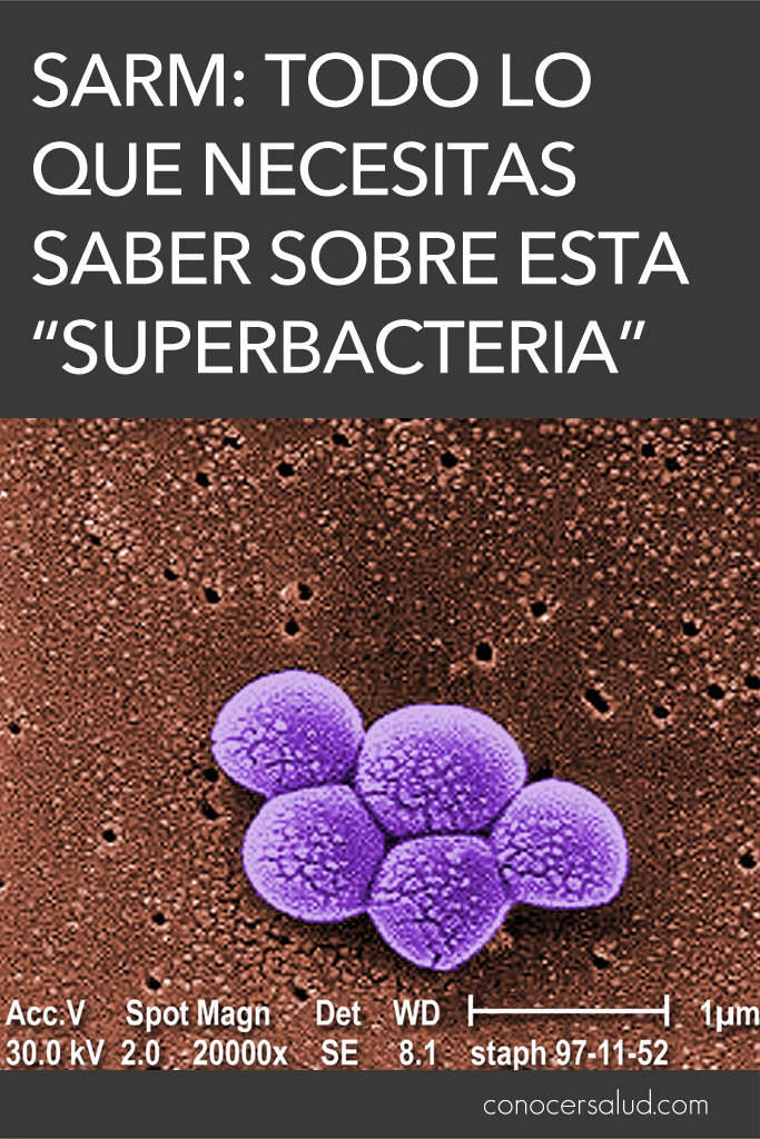 SARM: todo Lo que necesitas saber sobre esta "superbacteria"