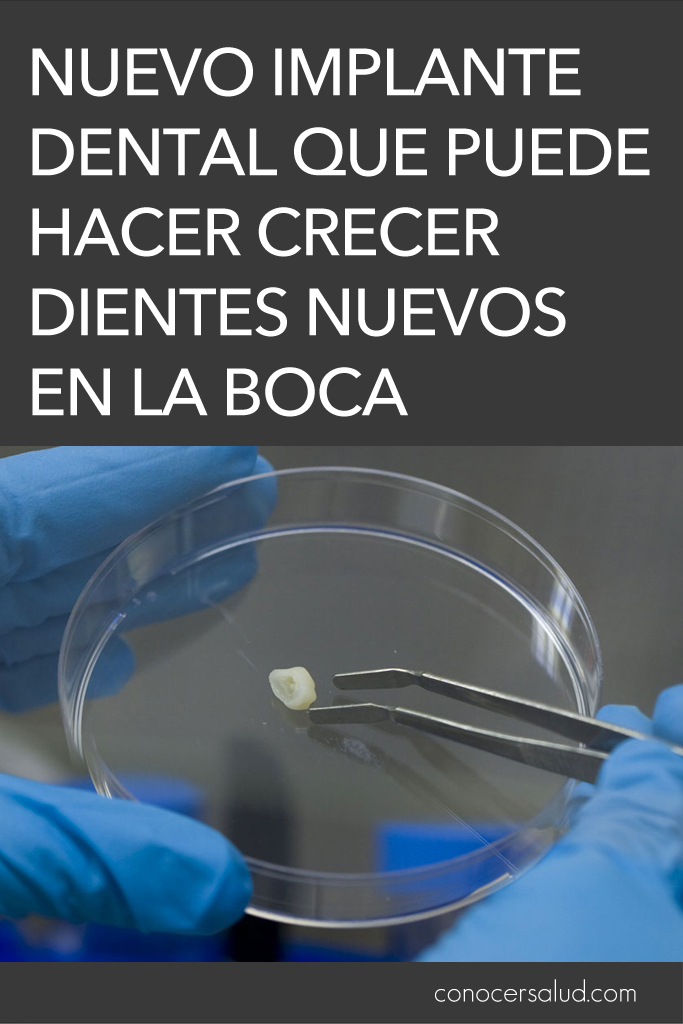 Asombroso nuevo implante dental que puede hacer crecer dientes nuevos en la boca