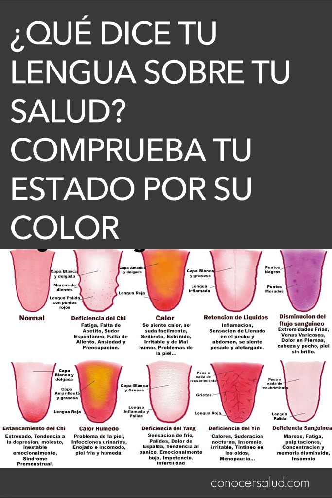 ¿Qué dice tu lengua sobre tu salud? Comprueba tu estado por su color