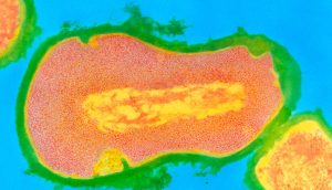 Nueva investigación: se encuentra un secreto del acné que apunta a nuevos tratamientos