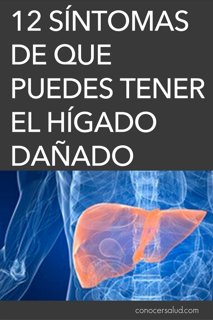 12 síntomas de que puedes tener el hígado dañado