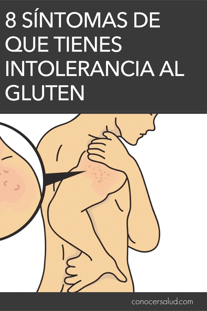 8 síntomas de que tienes intolerancia al gluten