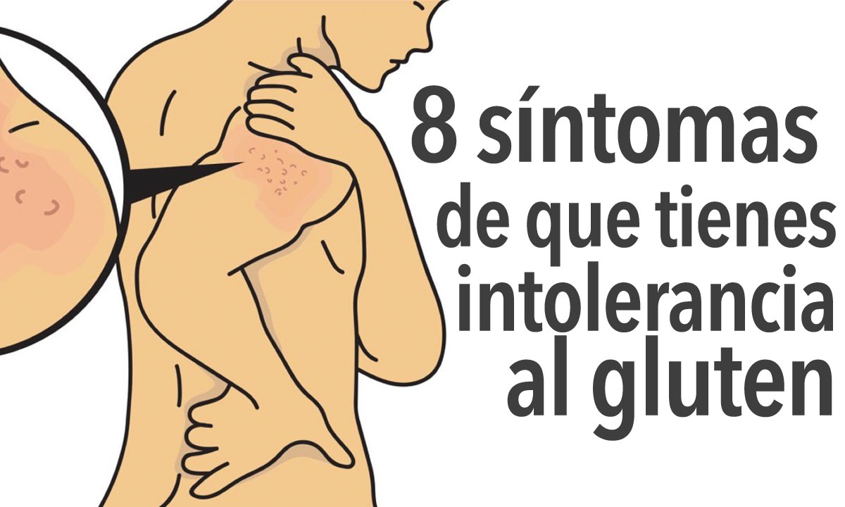 Sintomas de un celiaco si come gluten