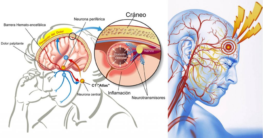 Añadir esta vitamina a tu dieta reduce el riesgo de migrañas frecuentes en un 50%