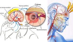 Añadir esta vitamina a tu dieta reduce el riesgo de migrañas frecuentes en un 50%