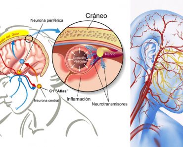 Añadir esta vitamina a tu dieta reduce el riesgo de migrañas frecuentes en un 50%