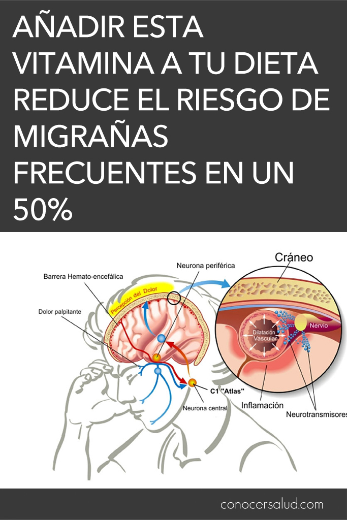 Añadir esta vitamina a tu dieta reduce el riesgo de migrañas frecuentes en un 50%