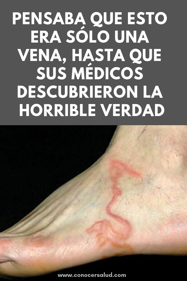 Pensaba que esto era sólo una vena, hasta que sus médicos descubrieron la horrible verdad