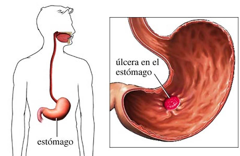 Si comes 2 plátanos al día durante un mes, esto es lo que sucede en tu cuerpo