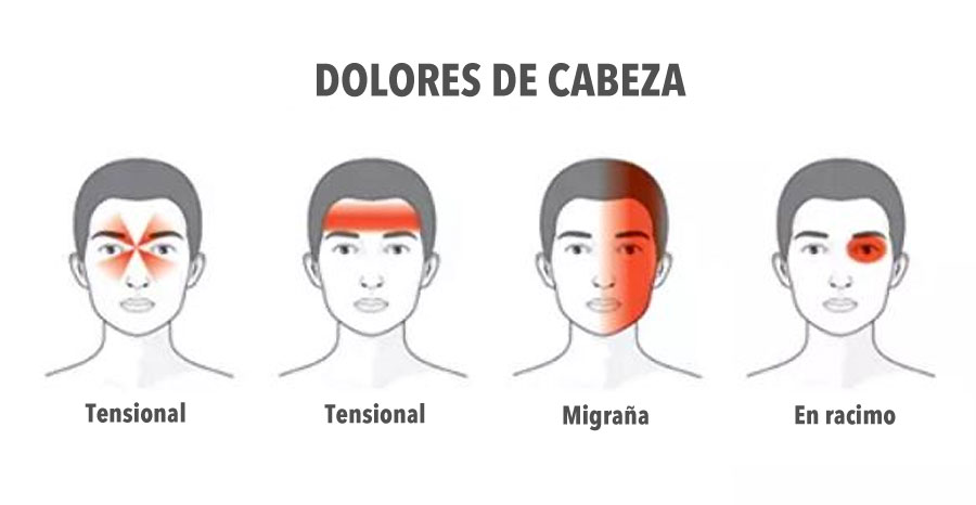 Estos consejos útiles te enseñarán a reconocer rápidamente dolores de cabeza PELIGROSOS