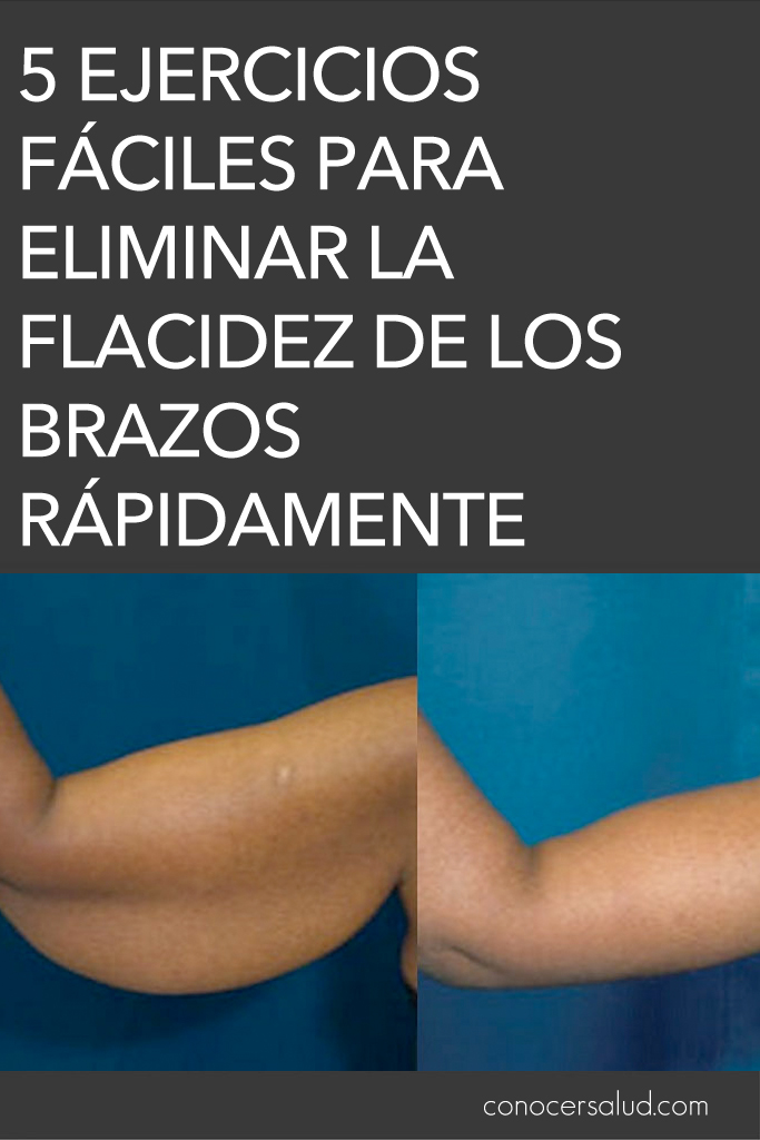 5 Ejercicios fáciles para eliminar la flacidez de los brazos rápidamente