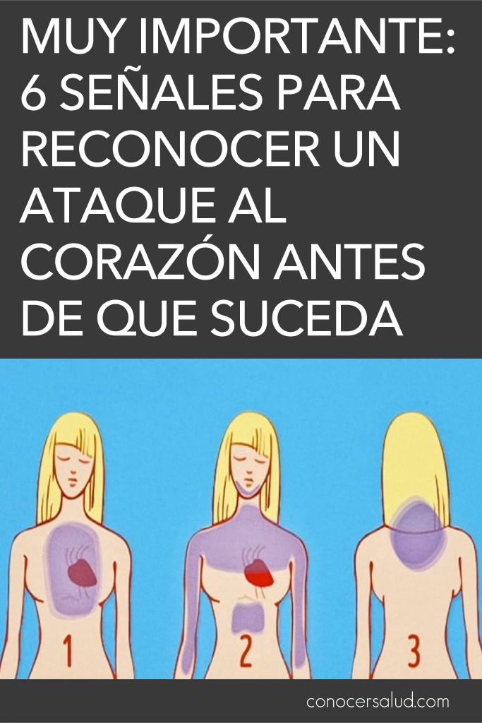 MUY IMPORTANTE: 6 señales para reconocer un ataque al corazón antes de que suceda