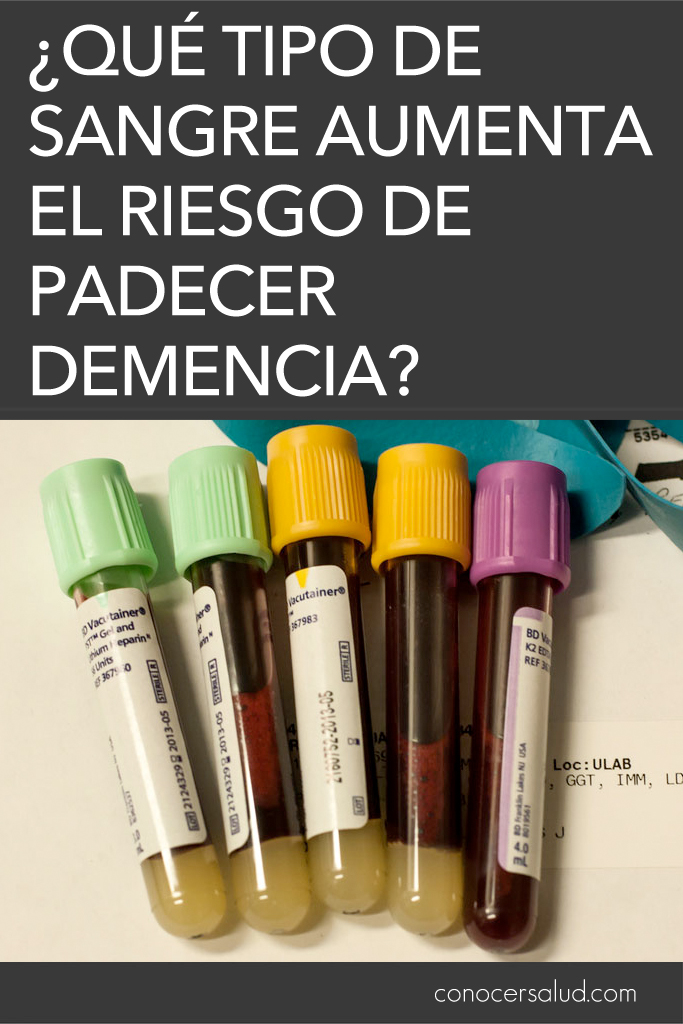 ¿Qué tipo de sangre aumenta el riesgo de padecer demencia?