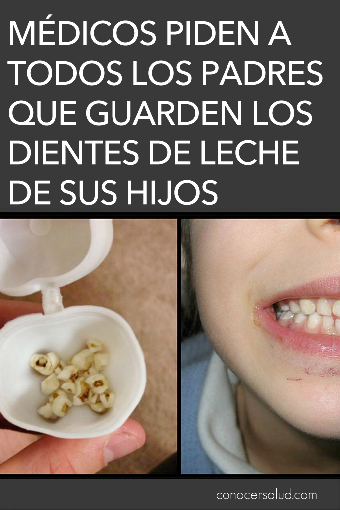 Médicos piden a todos los padres que guarden los dientes de leche de sus hijos