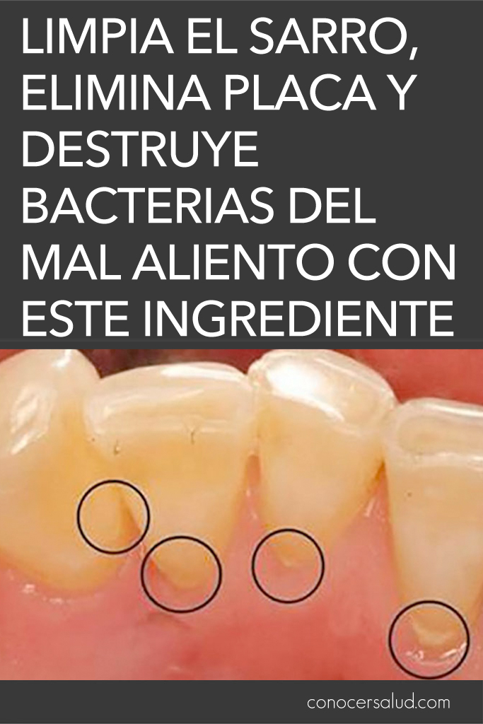 Limpia el sarro, elimina placa y destruye bacterias del mal aliento con este ingrediente