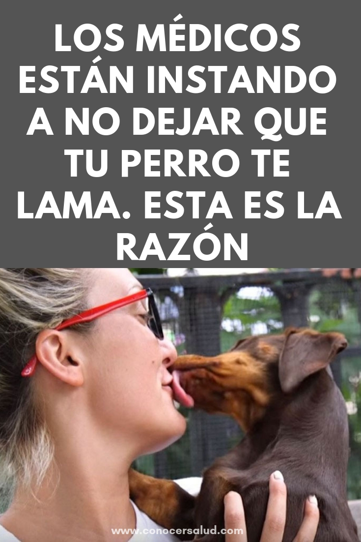 Los médicos están instando a no dejar que tu perro te lama. Esta es la razón