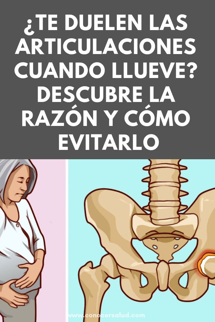 ¿Te duelen las articulaciones cuando llueve? Descubre la sorprendente razón y cómo evitarlo