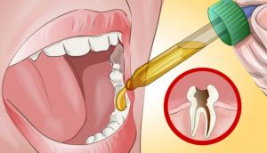 Mi dentista se sorprendió cuando le dije cómo puedo aliviar mi dolor de muelas por mí mismo