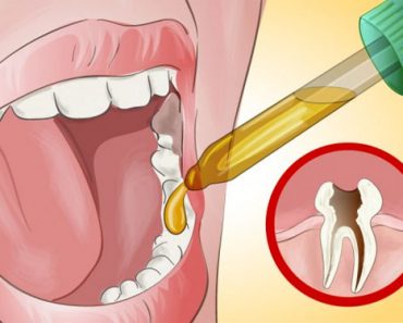 Mi dentista se sorprendió cuando le dije cómo puedo aliviar mi dolor de muelas por mí mismo