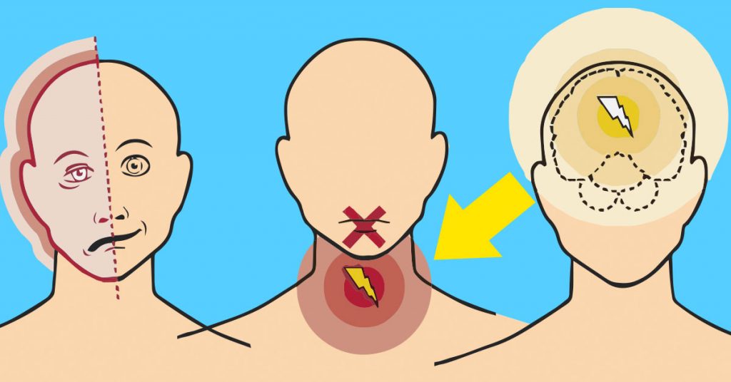 8 Síntomas que tu cuerpo te muestra antes de sufrir un infarto o derrame cerebral