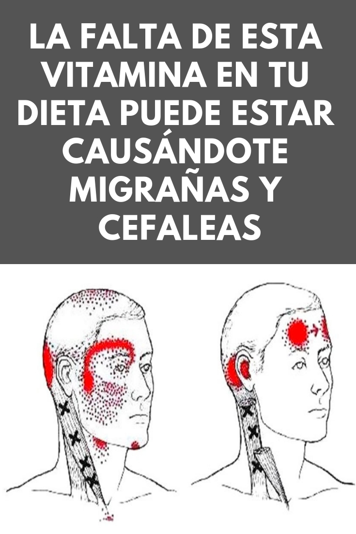 La falta de esta vitamina en tu dieta puede estar causándote migrañas y cefaleas