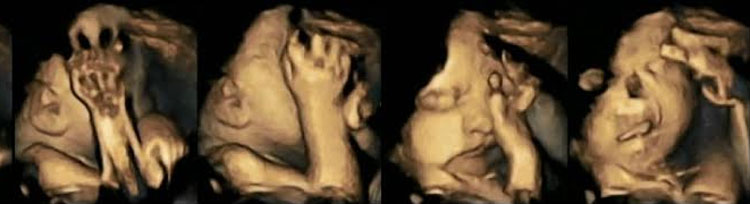 Terribles imágenes en 4D que muestran el efecto del tabaco en el desarrollo del bebé