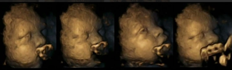Terribles imágenes en 4D que muestran el efecto del tabaco en el desarrollo del bebé