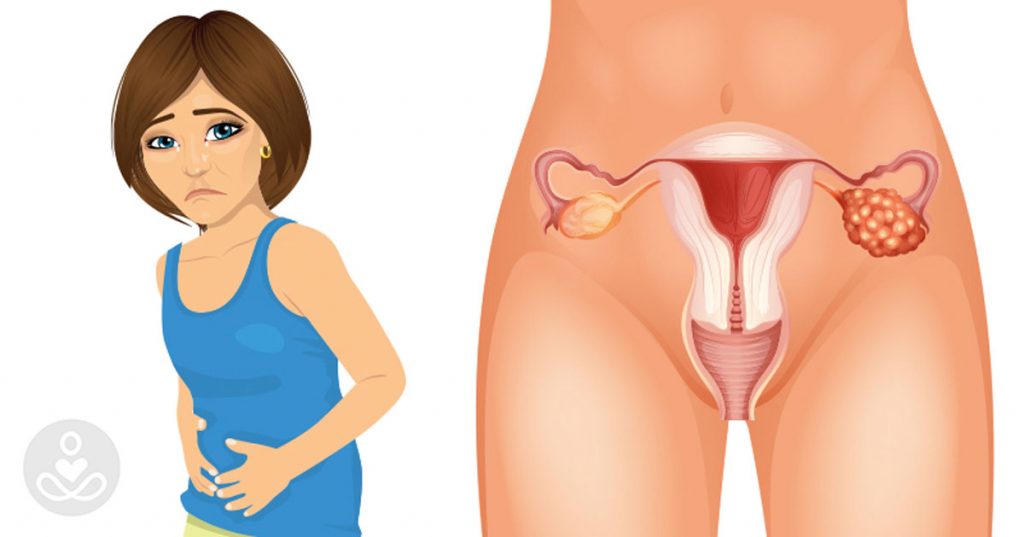 4 primeros síntomas de cáncer de ovario que cada mujer necesita saber