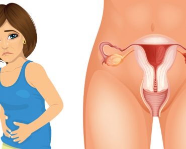 4 primeros síntomas de cáncer de ovario que cada mujer necesita saber