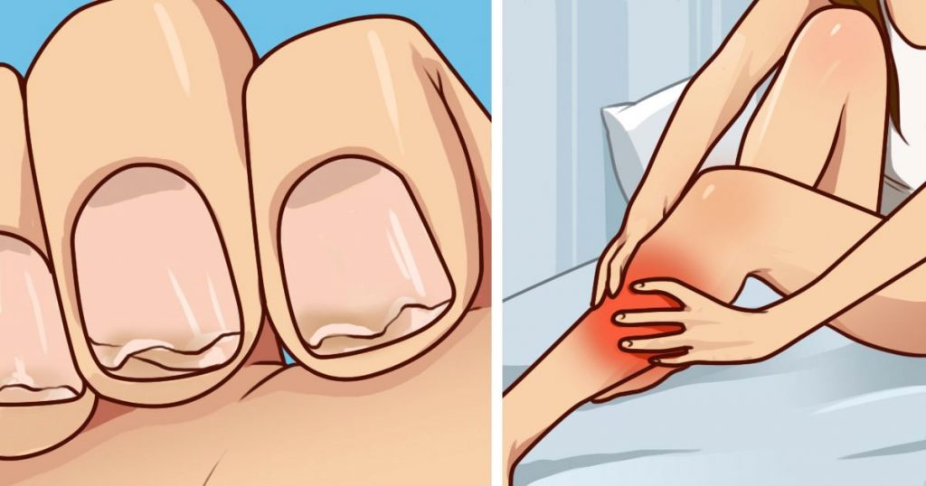 ¿Tiene las uñas débiles? ¿Calambres frecuentes en las piernas? Esto es lo que necesita saber