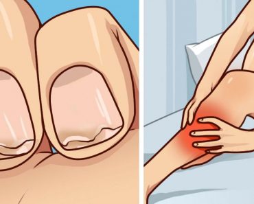 ¿Tiene las uñas débiles? ¿Calambres frecuentes en las piernas? Esto es lo que necesita saber ¿Tiene las uñas débiles? ¿Calambres frecuentes en las piernas? Esto es lo que necesita saber
