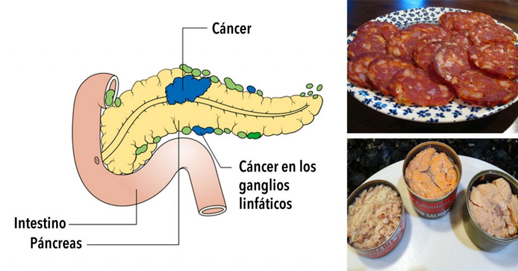11 Alimentos cancerígenos que nunca debes poner en tu boca otra vez