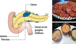 11 Alimentos cancerígenos que nunca debes poner en tu boca otra vez